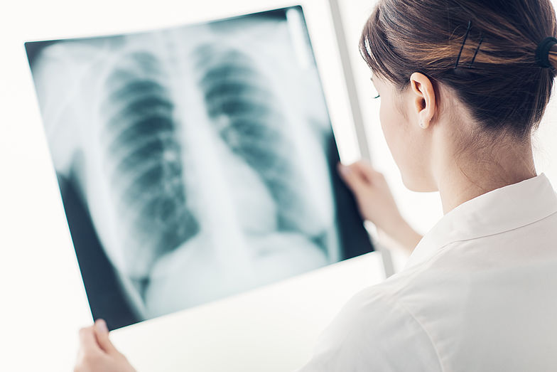 Auf dem Thorax-Röntgenbild lassen sich leichte COPD-Formen aber nur schwer erkennen. Auch bei einer schweren COPD-Erkrankung ist das Röntgen des Brustkorbs meist überflüssig. 