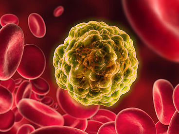 Krebszelle mit Blutplättchen in Blutbahn