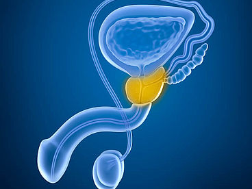 Röntgenaufnahme der Prostata und männliches Fortpflanzungsorgan