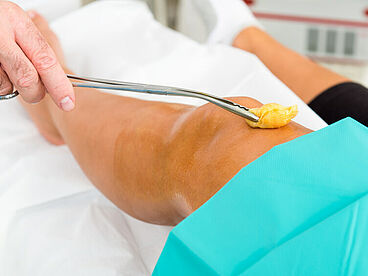 Desinfektion des OP-Bereiches bei einer Knie-Operation